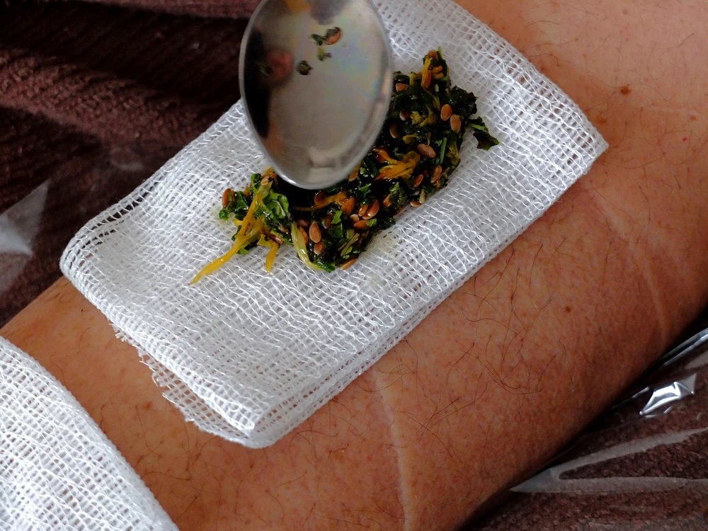 cataplasma