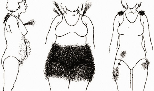 larvas