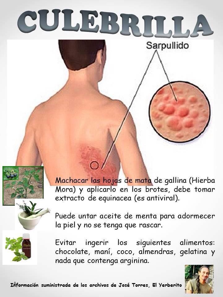 culebrilla3